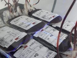 Acelerador linear da Santa Casa realiza irradiação de bolsas de sangue 